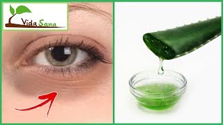 5 Tips Caseros para Eliminar Las Ojeras  Vida Sana [upl. by Ku]