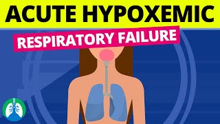 Acute Hypoxemic Respiratory Failure Medical Definition [upl. by Egan]