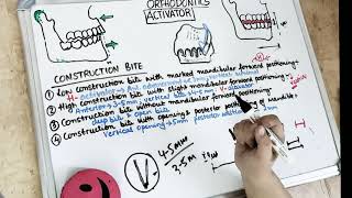 activator in orthodontics lecture I part 2 [upl. by Kori570]