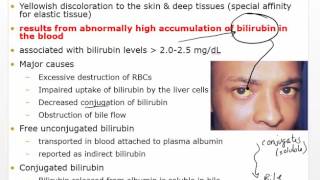 Chapter 30 Video Disorders of Hepatobiliary Liver and Pancreatic [upl. by Eiltan68]