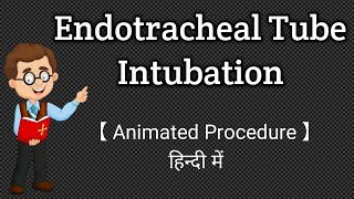 Endotracheal Tube Intubation  Animated Procedure  Hindi [upl. by Eural758]