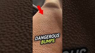 What Are These Weird Bumps 😨 viral [upl. by Aihseuqram]