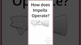 HOW DOES IMPELLA OPERATE PHYSICS impella [upl. by Atinihc208]