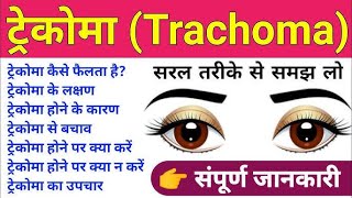 TRACHOMA BY DRPAWAN GUPTA [upl. by Ellednahc]