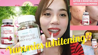 NATURE GLOW GLUTATHIONE COLLAGEN GLOW SKIN WHITENING GUMMIES Ms Sungit [upl. by Attelliw]