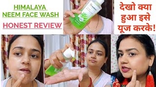 HIMALAYA NEEM FACE WASH  Honest review on Himalaya purifying neem face wash  Acne Pimples Problem [upl. by Yorel277]