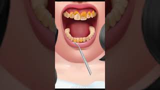 Experience the ASMR Magic of Dental Cleaning ✨🦷 asmr shorts youtubeshorts [upl. by Tamah]