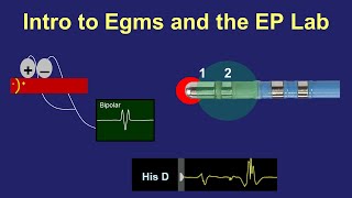 Intro to Intracardiac Electrograms amp the EP Lab [upl. by Airehs]