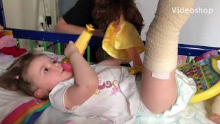 Hospital Hip Traction Toddler DDH start of 8 month hip dysplasia treatment [upl. by Leta]