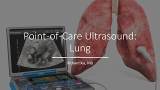 Point of Care Ultrasound POCUS  Lung [upl. by Ahsinek]