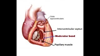 Moderator bandseptomarginal trabeculum of heart [upl. by Elconin]