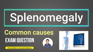 Splenomegaly Exam Question [upl. by Alexandrina]