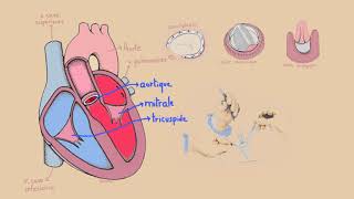 LES Valvuloplasties cardiaques [upl. by Notyep]