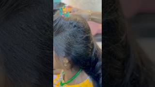 Lice Treatment   Thrissur [upl. by Nonnek]