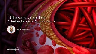 Diferença entre Arteriosclerose e Aterosclerose  Por Dr Roderick [upl. by Wojcik]