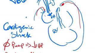 Central Venous Oxygen Saturation  Dr Jamal USMLE [upl. by Rennat]