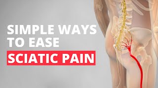 Sciatica Try These 4 Simple Poses [upl. by Kruse]