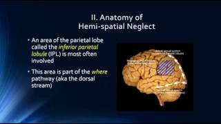 Neurophysiology of Attention Hemispatial Neglect [upl. by Kennith765]