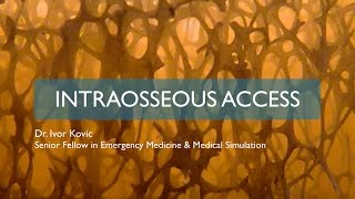 Intraosseous access [upl. by Truscott]