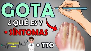 ¿QUÉ ES LA GOTA Y CUÁLES SON LOS SÍNTOMAS TRATAMIENTO 📝👨🏻‍⚕️ EXPLICACIÓN FÁCIL⚡ [upl. by Etiragram307]