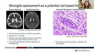 Sonia Lombroso Engineering an inhibitorresistant human CSF1R variant for microglia replacement [upl. by Amir645]