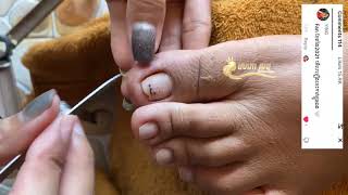 cleaning and cutting toenail thank for watching my video1 [upl. by Arit365]