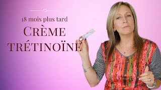 Crème trétinoïne RetinA 18 mois plus tard beauté 40 ans [upl. by Nylirak551]