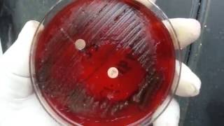 Anaerobic bacteria isolation in Microbiology  Clostridium [upl. by Ynnhoj452]