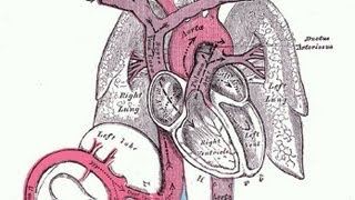 Why does Aortic Rupture cause so many deaths [upl. by Applegate]