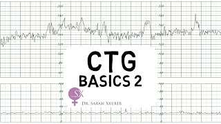 CTG Basics Part 2  Decelerations amp Fetal Physiology [upl. by Elaina]