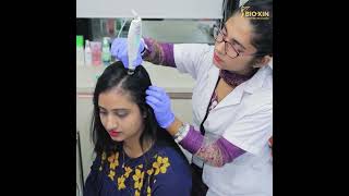 চুল পড়ার সমস্যা সমাধানে আছে Advanced EPN Treatment hairtreatment bioxincosmeceuticals [upl. by Uyekawa968]