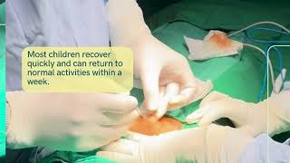 Umbilical hernia in children Surgery is needed if not resloved by age 2 years [upl. by Essyla]