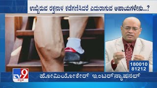 Nimma Doctor  Treatment For Varicose Veins  Homeocare International 23112021 [upl. by Nnaear262]