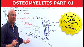 Osteomyelitis  Symptoms amp Causes🩺 [upl. by Rose]