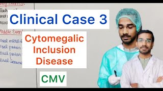 Clinical Case 3  Cytomegalic Inclusion Disease  CMV [upl. by Rol189]