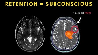 How SPERM RETENTION purifies your SUBCONSCIOUS Mind Blowing [upl. by Aowda]