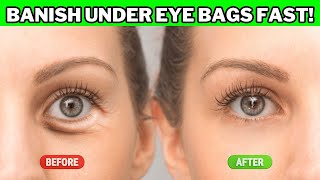 5 Natural Ways to Get Rid of Under Eye Bags  Skincare Tips [upl. by Delp]