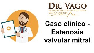 Estenosis Valvular Mitral  Caso Clínico ENARM [upl. by Nodnarg]