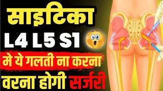 स्पाइन सर्जरी से कैसे बचेंL4 L5 Disc Bulge Treatment Without SurgeryDisc Bulge Treatment In Hindi [upl. by Tiras275]