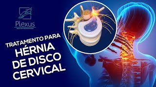 Hérnia de disco cervical  O que é e como é o tratamento [upl. by Necila81]