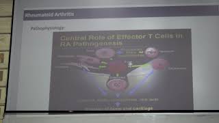 Rheumatology  CBL  Polyarthritis  DrWaleed [upl. by Brenza]