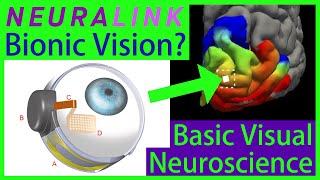 Can Neuralink Cure Blindness Superhuman Vision Brain Implant vs Retinal Implant [upl. by Yeldahc]