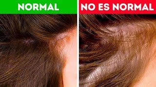 ¿Qué alimentos comer para evitar la caída del cabello [upl. by Llerot]