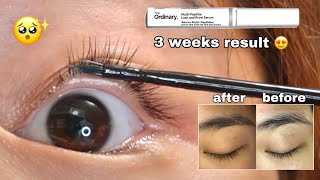 The Ordinary Lash and Brow Serum  Review Before amp After Photos [upl. by Okoyik741]