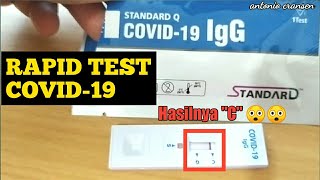 RAPID TEST COVID19 [upl. by Berna]