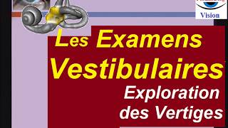 Différents examens vestibulaires diagnostic des vertiges [upl. by Arquit]