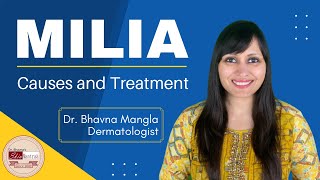 Milia removal treatment  Dermatologist  Skin specialist [upl. by Bunch]