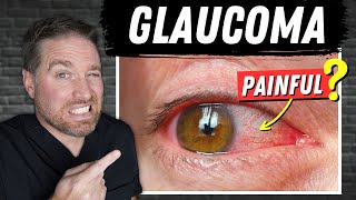 Open Vs Closed Angle Glaucoma Painful Glaucoma [upl. by Wright]