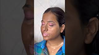 Vitiligo skin makeup mini tutorial quickandeasymakeuplook makeup [upl. by Enidualc]