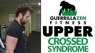 The BEST Exercises For Upper Crossed Syndrome [upl. by Myrah]